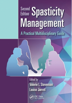 Spasticity Management