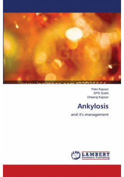 Ankylosis