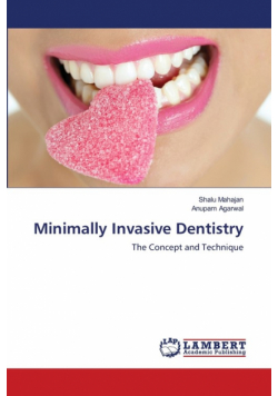 Minimally Invasive Dentistry