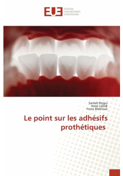 Le point sur les adhésifs prothétiques