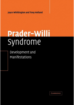 Prader-Willi Syndrome