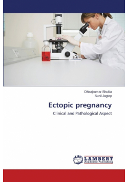 Ectopic pregnancy