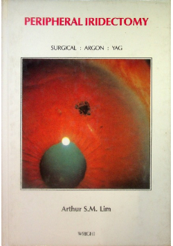 Peripheral Iridectomy