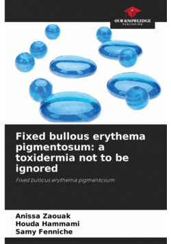 Fixed bullous erythema pigmentosum