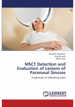 Msct Detection and Evaluation of Lesions of Paranasal Sinuses