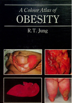 A Colour Atlas of Obesity.