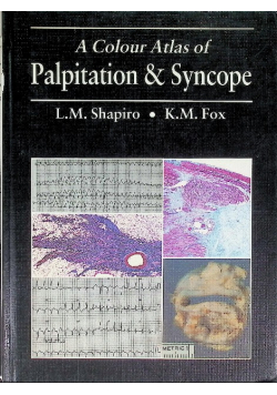 A Colour Atlas of Palpitation and Syncope