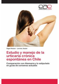 Estudio y manejo de la urticaria crónica espontánea en Chile