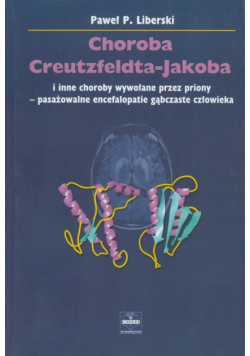 Choroba Creutzfeldta-Jakoba