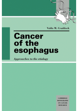 Cancer of the Esophagus