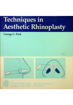 Techniques in Aesthetic Rhinoplasty