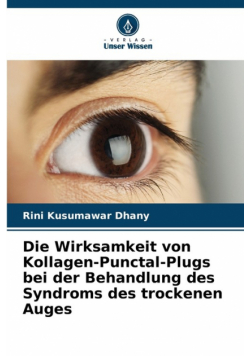 Die Wirksamkeit von Kollagen-Punctal-Plugs bei der Behandlung des Syndroms des trockenen Auges