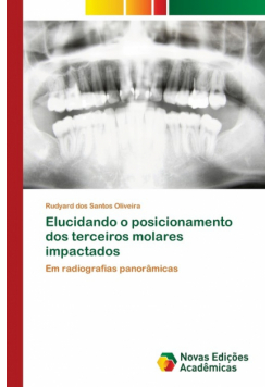 Elucidando o posicionamento dos terceiros molares impactados