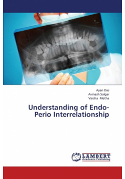Understanding of Endo-Perio Interrelationship
