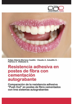 Resistencia adhesiva en postes de fibra con cementación autograbante