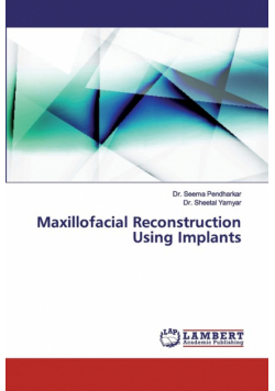 Maxillofacial Reconstruction Using Implants
