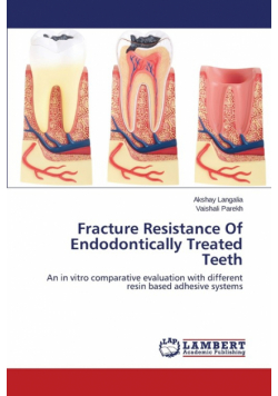 Fracture Resistance of Endodontically Treated Teeth