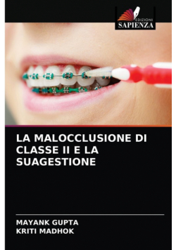 La Malocclusione Di Classe Ii E La Suagestione
