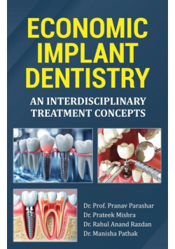 Economic Implant Dentistry