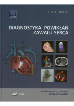 Diagnostyka powikłań zawału serca