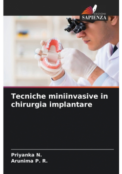 Tecniche miniinvasive in chirurgia implantare