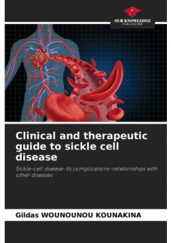 Clinical and therapeutic guide to sickle cell disease