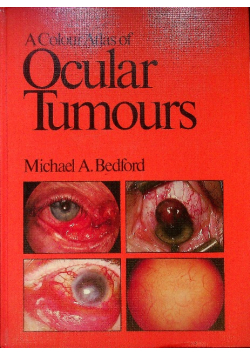 A Colour Atlas of Ocular