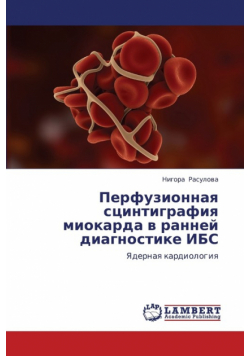 Perfuzionnaya Stsintigrafiya Miokarda V Ranney Diagnostike Ibs