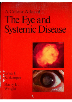 A Colour Atlas Of The Eye And Systemic Diseases