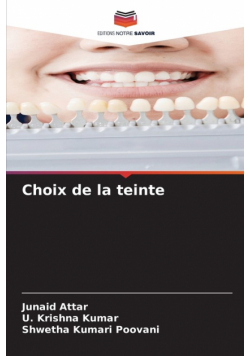 Choix de la teinte