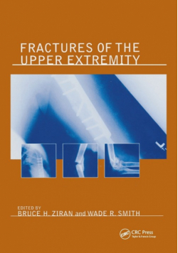 Fractures of the Upper Extremity