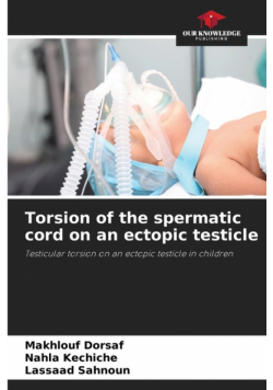 Torsion of the spermatic cord on an ectopic testicle