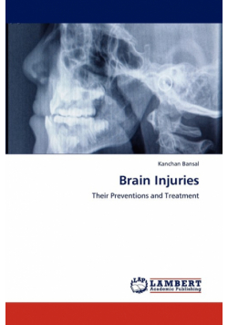 Brain Injuries