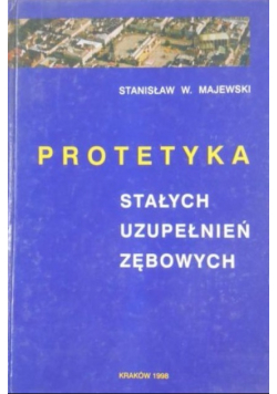 Protetyka stałych uzupełnień zębowych