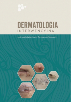 Dermatologia interwencyjna