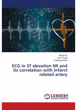 ECG in ST elevation MI and its correlation with infarct related artery