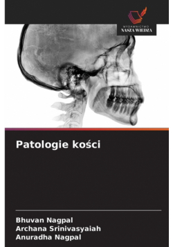 Patologie kości