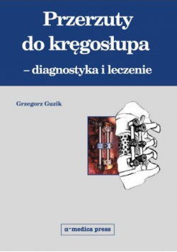 Przerzuty do kręgosłupa