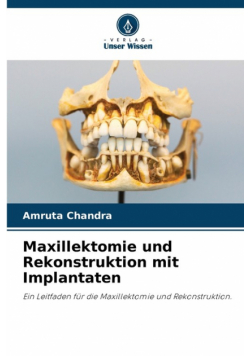 Maxillektomie und Rekonstruktion mit Implantaten
