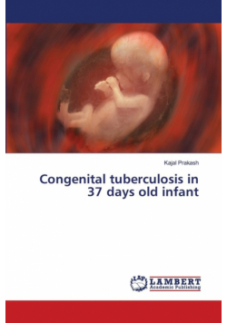 Congenital tuberculosis in 37 days old infant