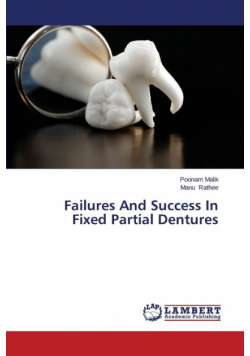 Failures And Success In Fixed Partial Dentures