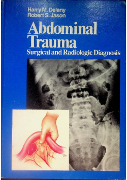 Abdominal trauma