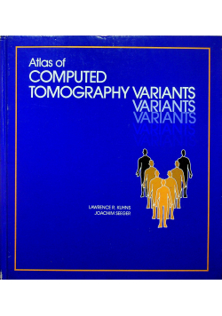 Atlas of computed tomography variants