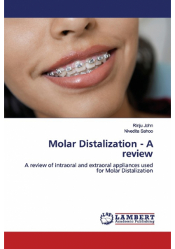 Molar Distalization - A review