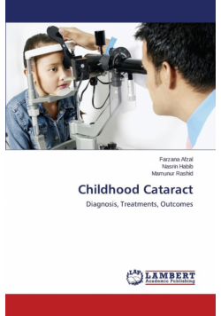 Childhood Cataract