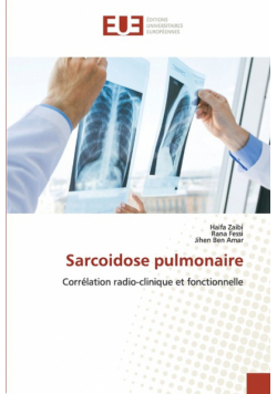 Sarcoidose pulmonaire