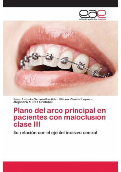 Plano del arco principal en pacientes con maloclusión clase III