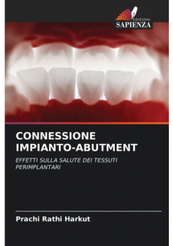 Connessione Impianto-Abutment