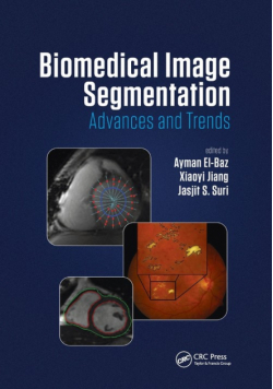 Biomedical Image Segmentation