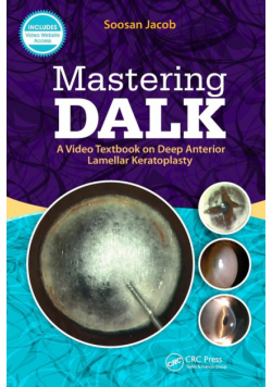 Mastering DALK